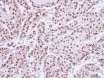 MST1 (STK4) Antibody in Immunohistochemistry (Paraffin) (IHC (P))