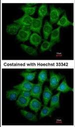 UBE4B Antibody in Immunocytochemistry (ICC/IF)