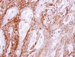 UBE4B Antibody in Immunohistochemistry (Paraffin) (IHC (P))