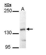 UBE4B Antibody in Western Blot (WB)