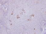 PHKA1 Antibody in Immunohistochemistry (Paraffin) (IHC (P))