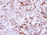 AKR1B10 Antibody in Immunohistochemistry (Paraffin) (IHC (P))