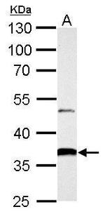 AKR1B10 Antibody in Western Blot (WB)