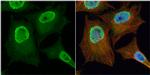 PGAM2 Antibody in Immunocytochemistry (ICC/IF)