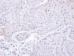 PSMC3 Antibody in Immunohistochemistry (Paraffin) (IHC (P))