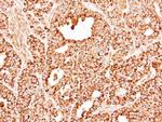 DECR1 Antibody in Immunohistochemistry (Paraffin) (IHC (P))