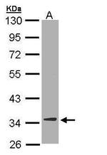 DECR1 Antibody in Western Blot (WB)