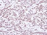 SMC1 Antibody in Immunohistochemistry (Paraffin) (IHC (P))