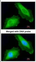 DDX3Y Antibody in Immunocytochemistry (ICC/IF)