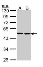 SUCLA2 Antibody in Western Blot (WB)