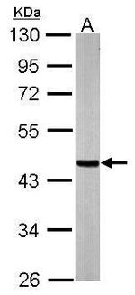 SUCLA2 Antibody in Western Blot (WB)