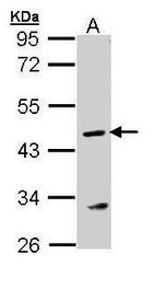 ASL Antibody in Western Blot (WB)