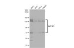 AUTS2 Antibody in Western Blot (WB)