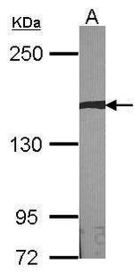 AUTS2 Antibody in Western Blot (WB)