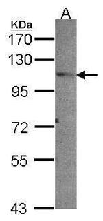 PEX6 Antibody in Western Blot (WB)