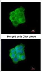 Cytokeratin 13 Antibody in Immunocytochemistry (ICC/IF)