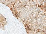 Cytokeratin 13 Antibody in Immunohistochemistry (Paraffin) (IHC (P))