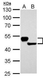 Cytokeratin 13 Antibody in Western Blot (WB)