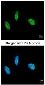 RBM15 Antibody in Immunocytochemistry (ICC/IF)