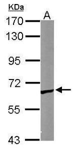 TCP-1 epsilon Antibody in Western Blot (WB)