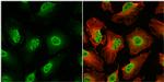 OGT Antibody in Immunocytochemistry (ICC/IF)