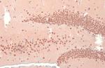 OGT Antibody in Immunohistochemistry (Paraffin) (IHC (P))