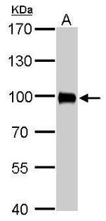 Villin Antibody in Western Blot (WB)