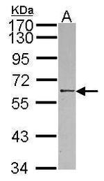 RBMY1A1 Antibody in Western Blot (WB)