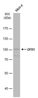 OFD1 Antibody in Western Blot (WB)