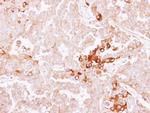 SERPINF2 Antibody in Immunohistochemistry (Paraffin) (IHC (P))