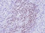 RBMY1A1 Antibody in Immunohistochemistry (Paraffin) (IHC (P))