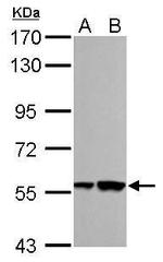 RBMY1A1 Antibody in Western Blot (WB)