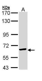 TCP-1 epsilon Antibody in Western Blot (WB)