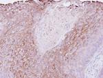 PIGR Antibody in Immunohistochemistry (Paraffin) (IHC (P))