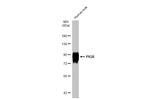 PIGR Antibody in Western Blot (WB)