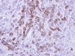 MX1 Antibody in Immunohistochemistry (Paraffin) (IHC (P))