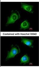 FKTN Antibody in Immunocytochemistry (ICC/IF)