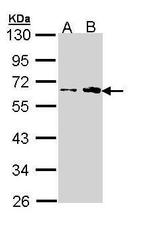 FKTN Antibody in Western Blot (WB)