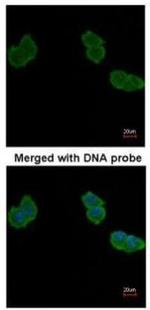 Aminoacylase Antibody in Immunocytochemistry (ICC/IF)