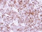 Factor XIII A Antibody in Immunohistochemistry (Paraffin) (IHC (P))