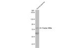 Factor XIII A Antibody in Western Blot (WB)