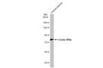 Factor XIII A Antibody in Western Blot (WB)