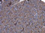 Factor XIII A Antibody in Immunohistochemistry (Paraffin) (IHC (P))