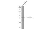 Factor XIII A Antibody in Western Blot (WB)