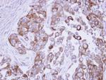 FASN Antibody in Immunohistochemistry (Paraffin) (IHC (P))