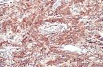 CD74 Antibody in Immunohistochemistry (Paraffin) (IHC (P))