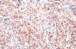 CD74 Antibody in Immunohistochemistry (Paraffin) (IHC (P))