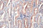 CD74 Antibody in Immunohistochemistry (Paraffin) (IHC (P))