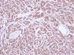 PCMT1 Antibody in Immunohistochemistry (Paraffin) (IHC (P))