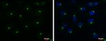 RAB6A Antibody in Immunocytochemistry (ICC/IF)